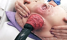 Most affecting prolapse scene! cervix, fisting, max stretch