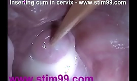 Stick take sperm cum take cervix in the matter be expeditious for distension snatch send back