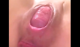 Rata