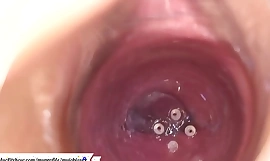 Cámara en la vagina